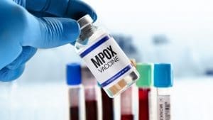 San Francisco Detects First Clade I Mpox Case; Health Officials Reassure Low Public Risk